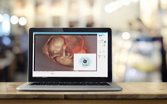 4DView of Voluson technology