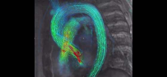 CIRCULATION UpーtoーDate 8ー3―現在と未来をになうCardiologistのための 進化した3Dイメージング 前編 CT・MRIの [大型本] uCT 780 - Medicare