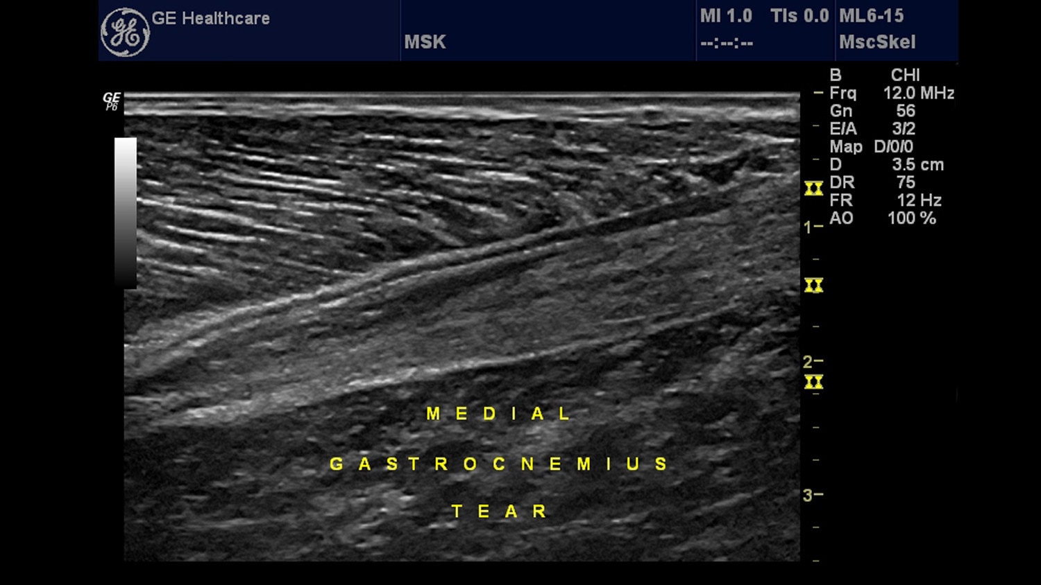 education-clinical-education-poc-musculoskeletal-gehc-poc-msk_spotlight_1_jpg