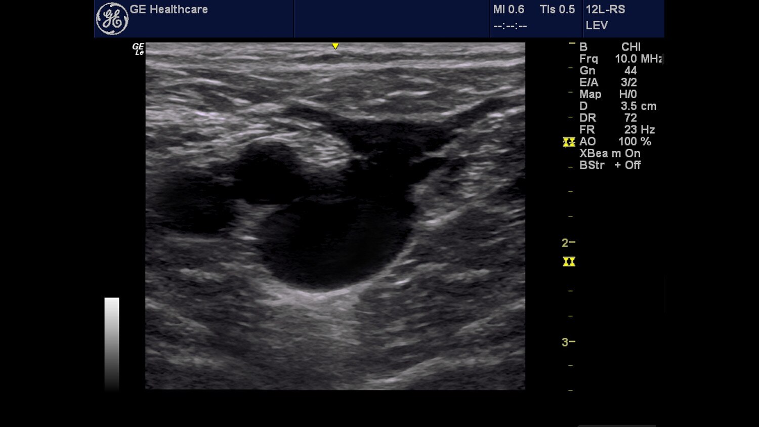 education-clinical-education-poc-venous-gehc-poc-venous_spotlight_1_jpg