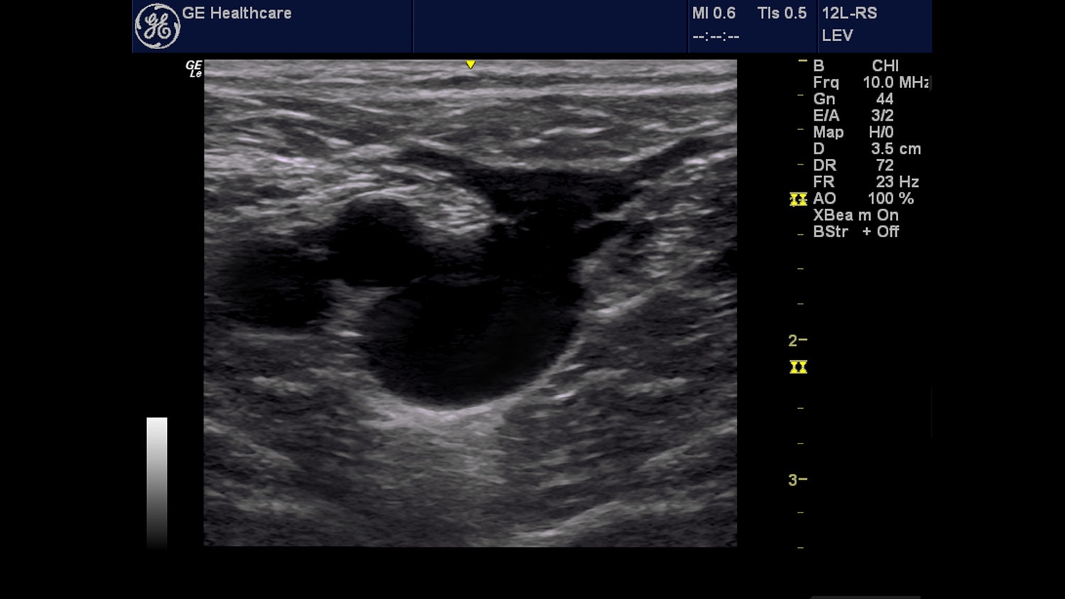 education-clinical-education-poc-venous-gehc-poc-venous_spotlight_1_jpg