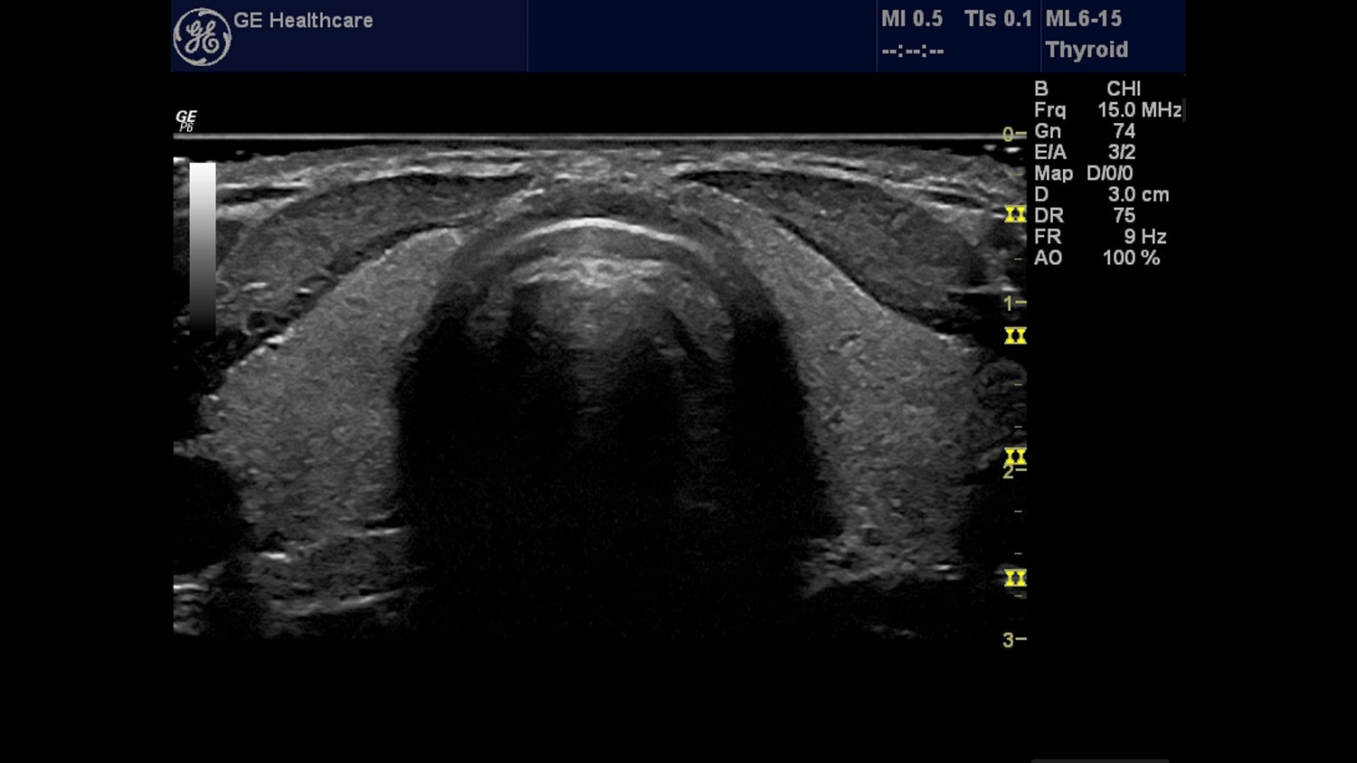 education-clinical-education-poc-head and neck-gehc-poc-head-neck_spotlight_1_jpg
