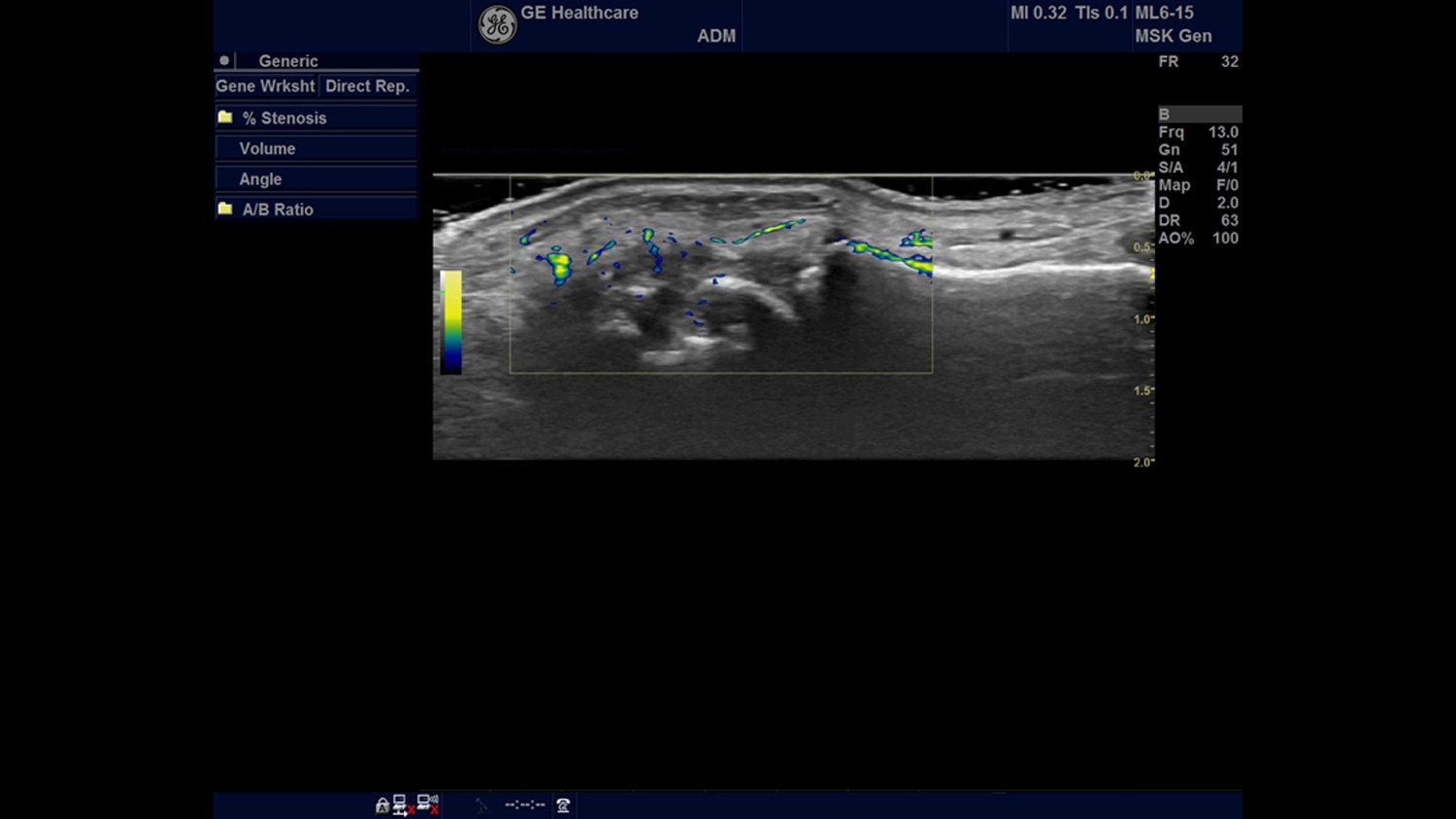 gehc-education-poc-rheumatology-b-flow_color_demonstrated_in_rheumatology patient copy_jpg