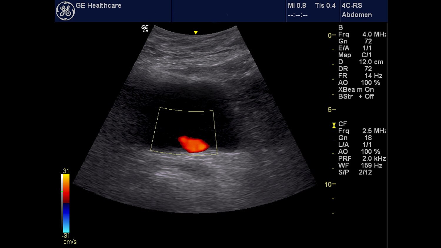 tion-clinical-education-poc-emergency medicine-gehc-poc-emergency-medicine_spotlight_1_jpg