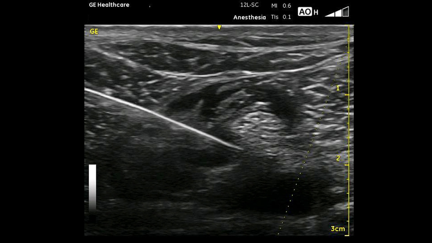 education-poc-anesthesia and chronic pain-gehc-poc-anesthesia-chronic-pain_spotlight_1_jpg