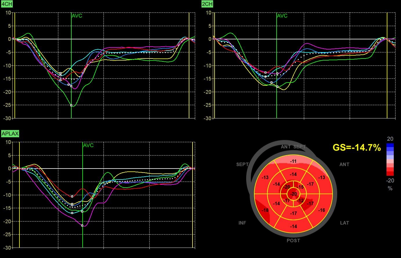 Automated Function Imaging (AFI) 2.0*