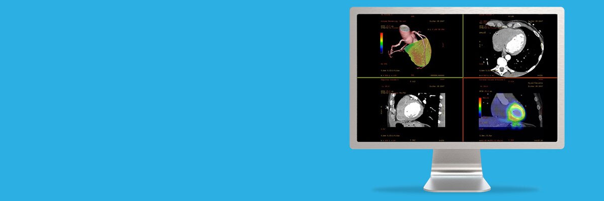 product-product-categories-do-not-clone-advanced-visualization-applications-cardiq fusion-aw-cardiq-fusion_spotlight.jpg