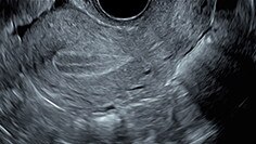 ct-product-categories-ultrasound-voluson-voluson-e8-e8 new images-gynecology-thumbnail.jpg