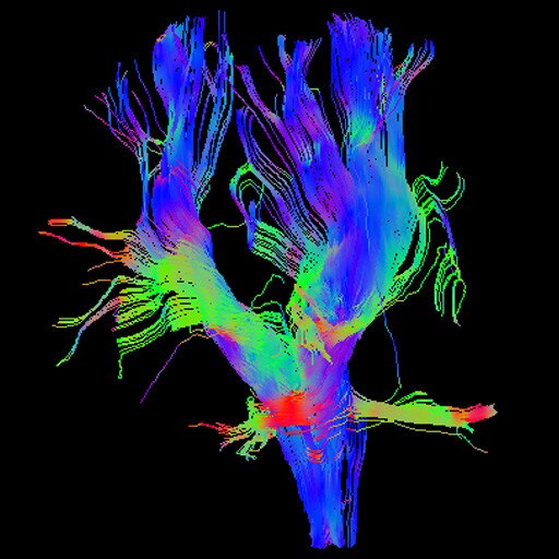Brain View