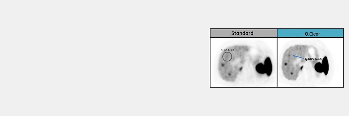 QClear-comparison