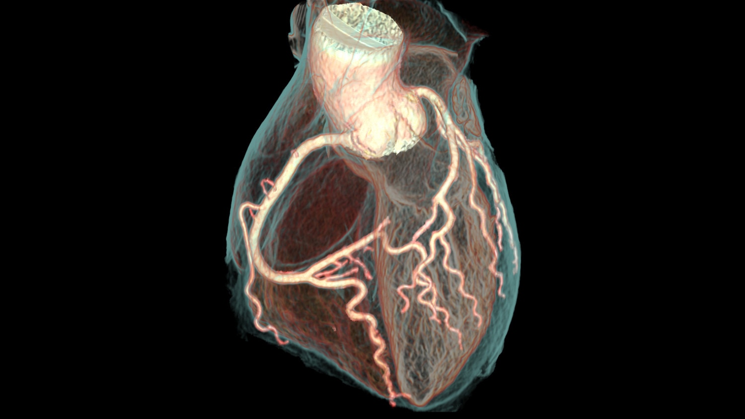 Revolution CT Computed Tomography Categories GE Healthcare