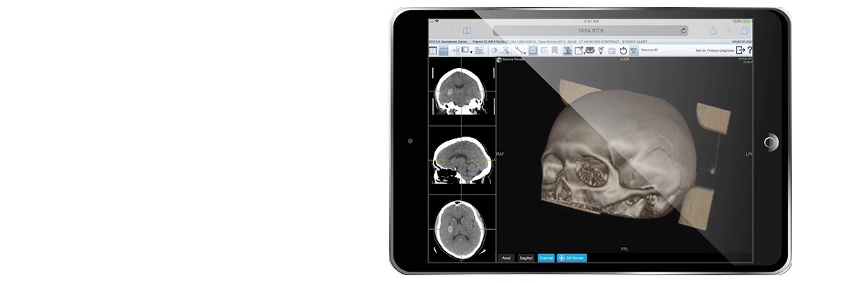 Centricity Universal Viewer Zero Footprint