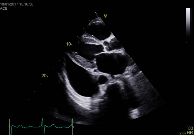True Confocal Imaging