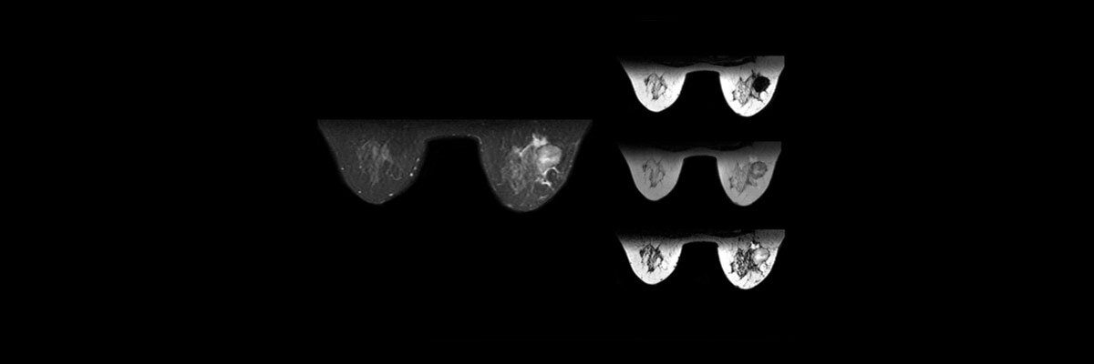 product-product-categories-magnetic-resonance-imaging-neuro-imaging-breast health.jpg
