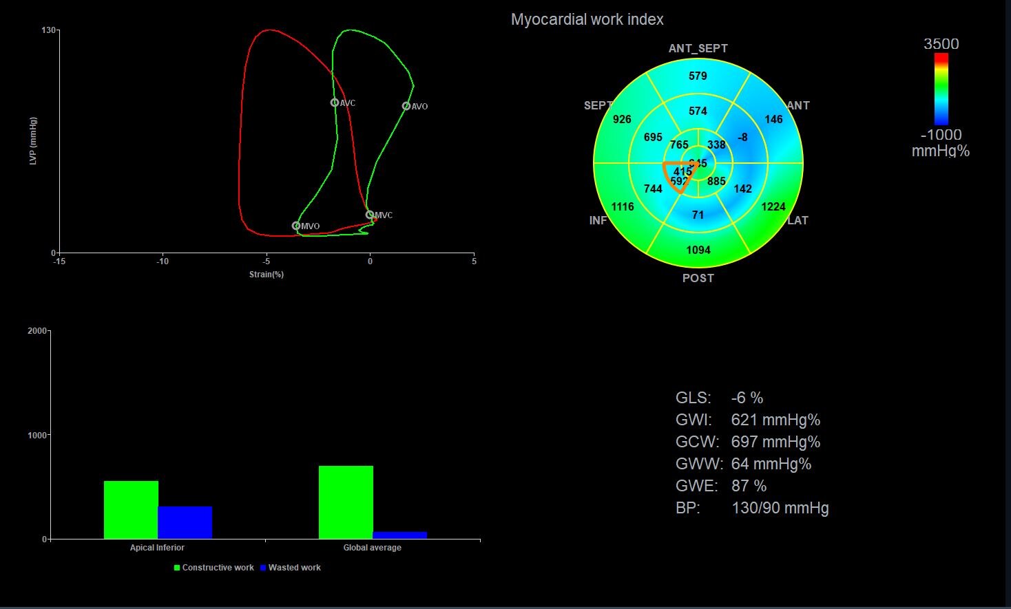 Myocardial Work*