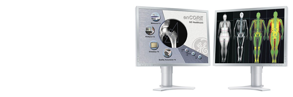 product-interoperability-ihe-bone-health-encore_panel_clinical_image.jpg