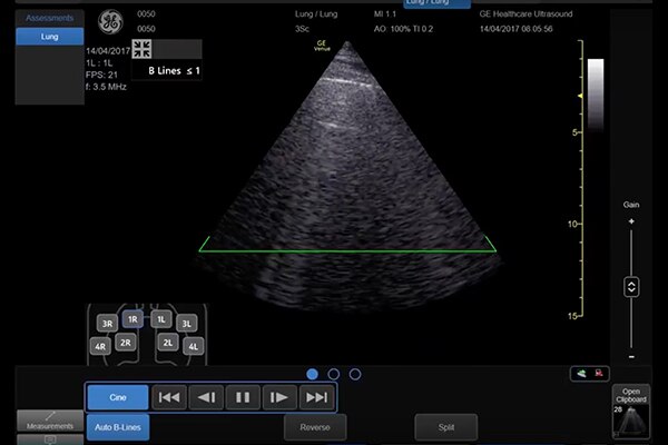 Venue Auto B-Lines Tool