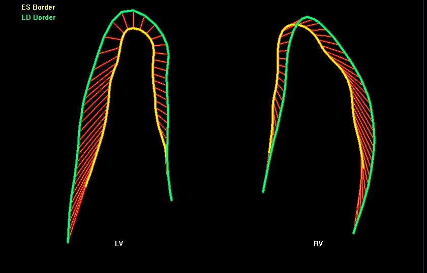 Fetal heart contractility demonstrated with fetalHQ