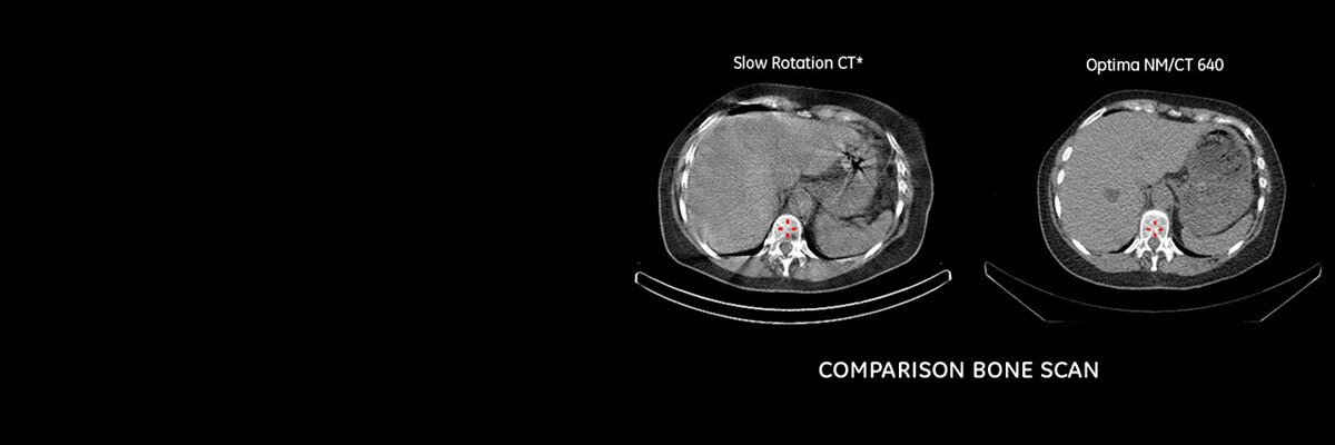 ct-ct scanners-optima-nm-ct-640-clinical image library-gehc_optima-nm-ct-640_fullbleed.jpg