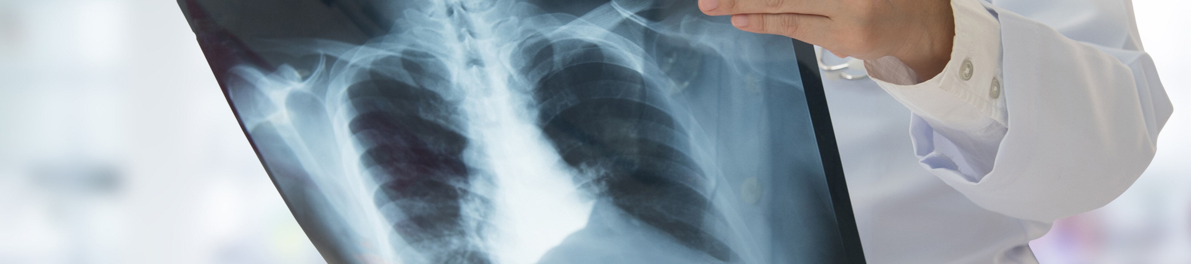 health professional holding x-ray