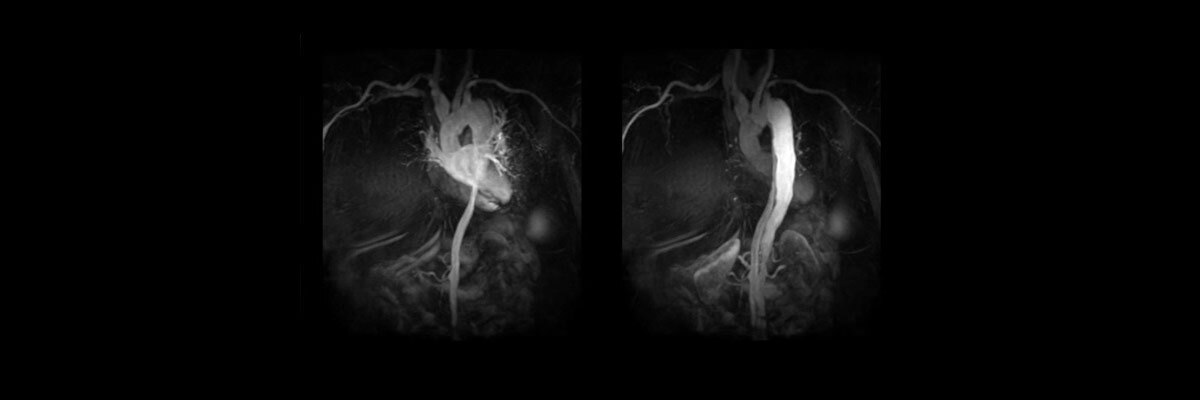 ategories-magnetic-resonance-imaging-vascular-imaging-tricks-tricks_vascular_spotlight.jpg