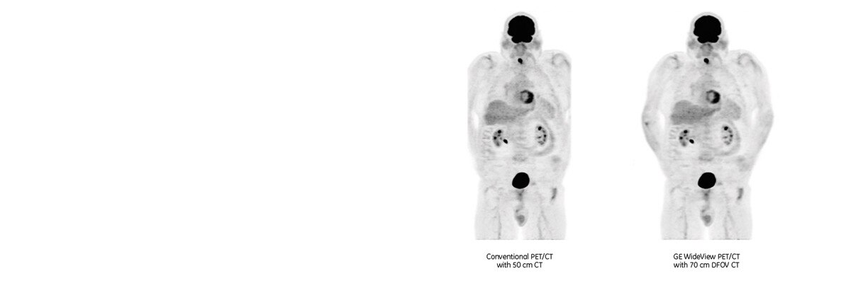 product-product-categories-pet-ct-wideview-discoverypetct600-wideview-comparison.jpg