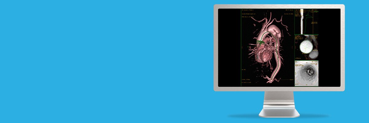 cloneadvancedvisualizationapplicationsmrvesseliqxpressawmrvesseliqspotlightjpg.jpg