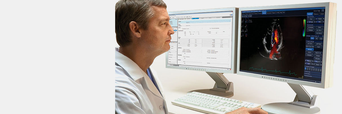 ct-categories-ultrasound-ultrasound-it-viewpoint for echopac and new suite-workstation.jpg