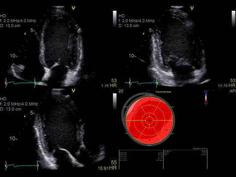 Automated Function Imaging