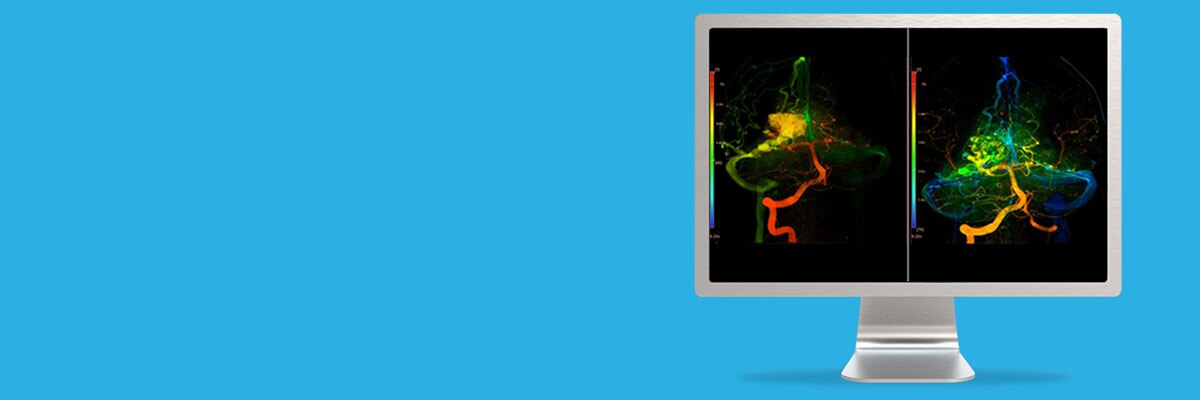 gories-do-not-clone-advanced-visualization-applications-angioviz-aw-angioviz-spotlight.jpg