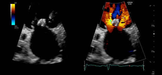 Dual Color Flow Jets, M5Sc-D