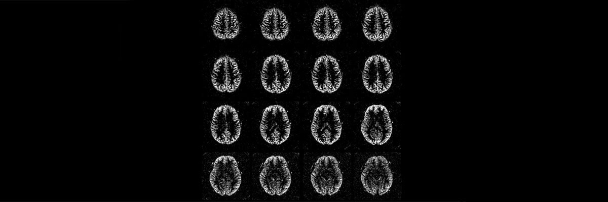 product-product-categories-magnetic-resonance-imaging-pediatric-imaging-ped_3d_asl.jpg