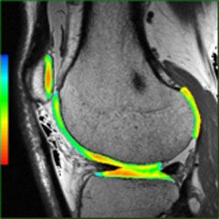 READY View clinical image