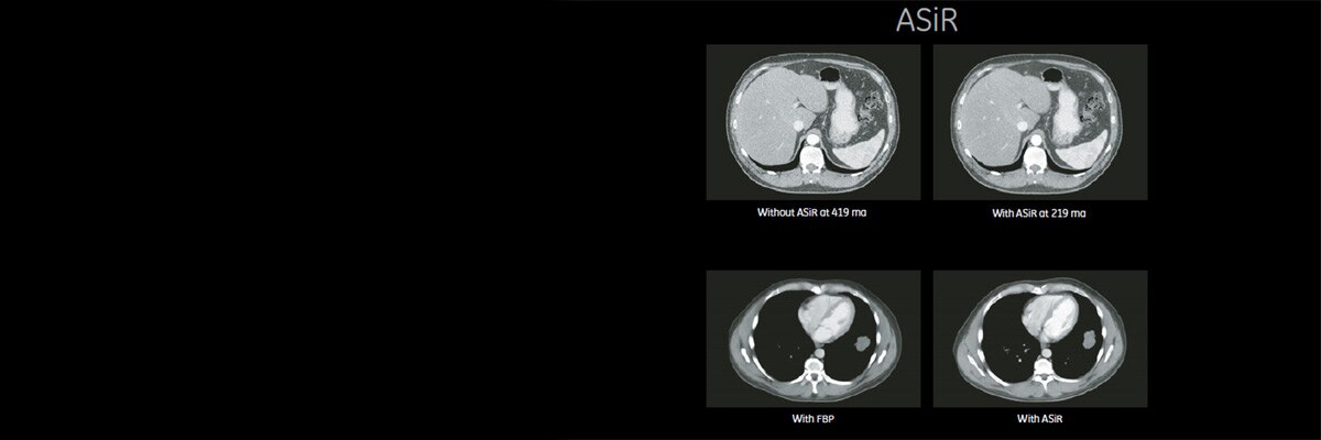 product-product-categories-pet-ct-asir-1-clinical-asir_d690_clinical.jpg