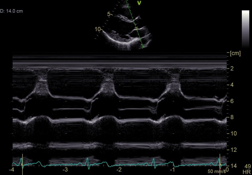 Anatomical M-Mode
