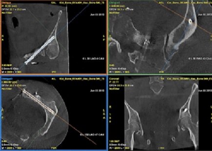 bone-interventional-assess.png