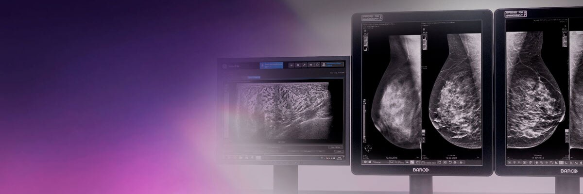 t-categories-mammography-mammography-new-banner-Mammo-application-and-solutions_banner.jpg