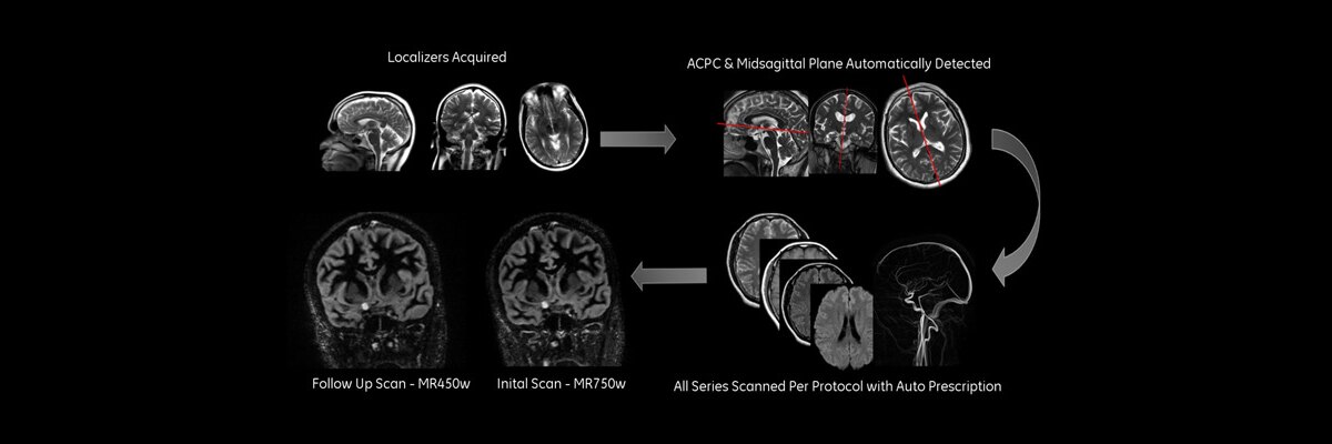 product-product-categories-magnetic-resonance-imaging-neuro-imaging-ready-brain-ready brain_ spotlight new.jpg