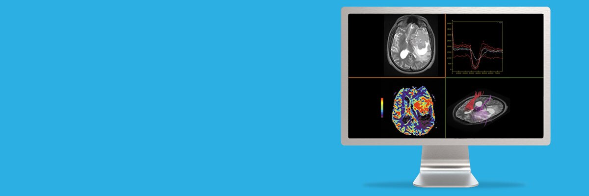 clone-advanced-visualization-applications-brain-view-plus-aw-brain-view-plus-spotlight.jpg