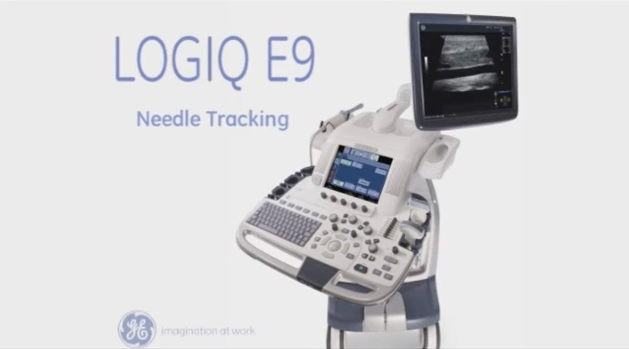 Logiq e9 датчики