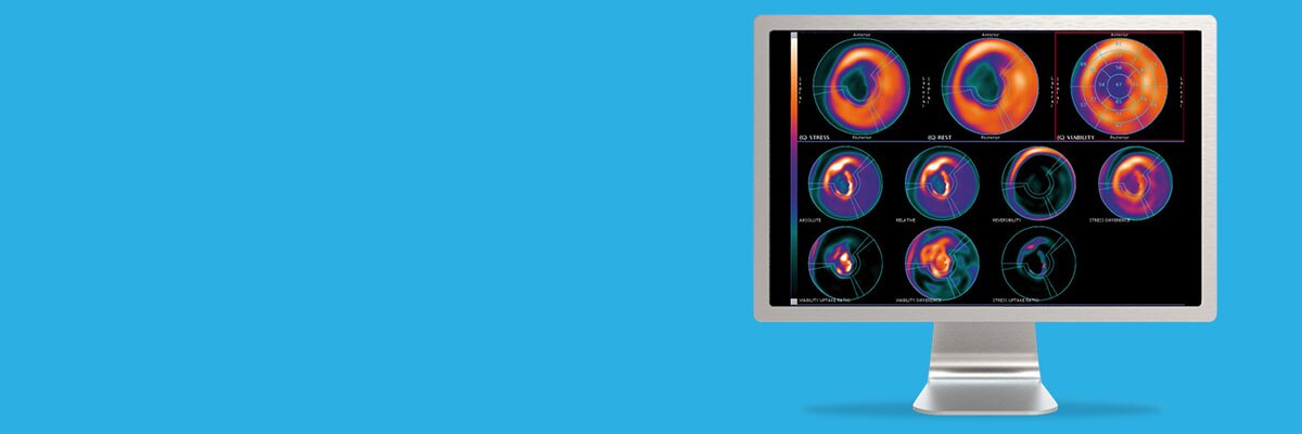 spotlight-cardiac-iq-physio