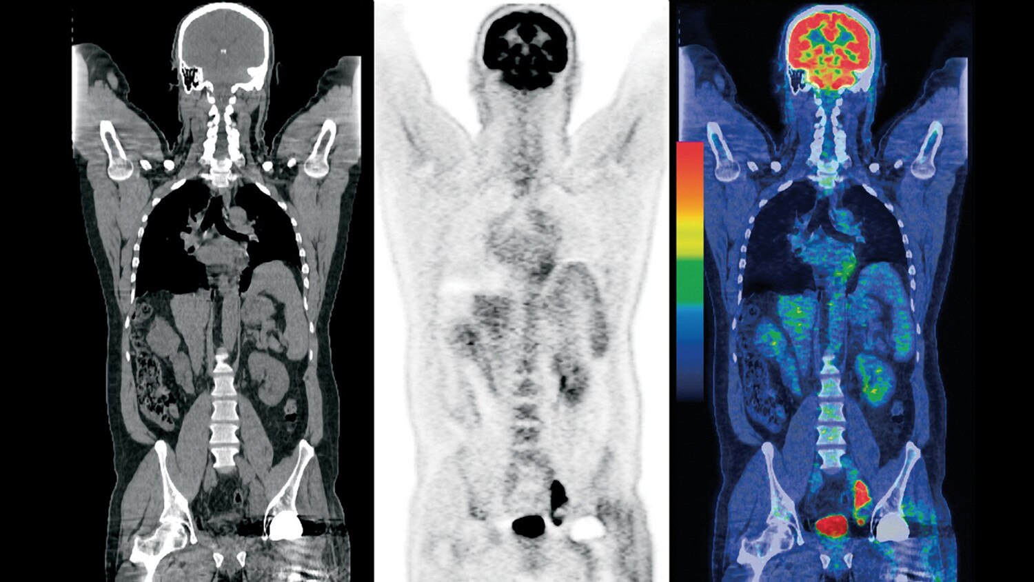 education-product-education-clinical-tip-applications-general-pet-pet - dste_clinical4.jpg