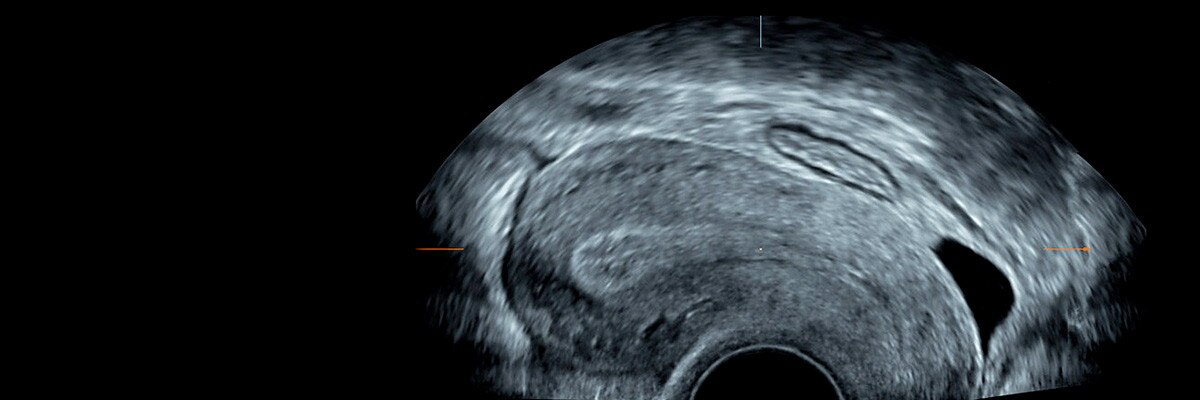 product-product-categories-ultrasound-voluson-voluson_p8-p6-uk_p8_hero-1.jpg
