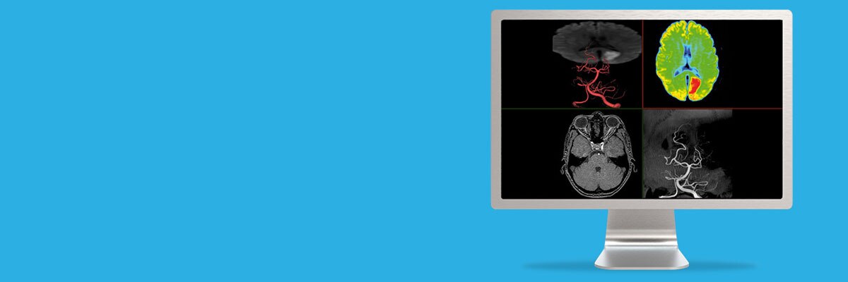 isualization-applications-integrated-registration-aw-integrated-registration-spotlight.jpg