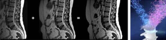 SIGNA™ Architect – 70 cm | GE Healthcare