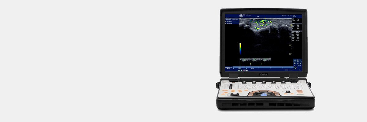 t-product-categories-ultrasound-point-of-care-new-logiq-e-ultrasound-main-image_080615.jpg