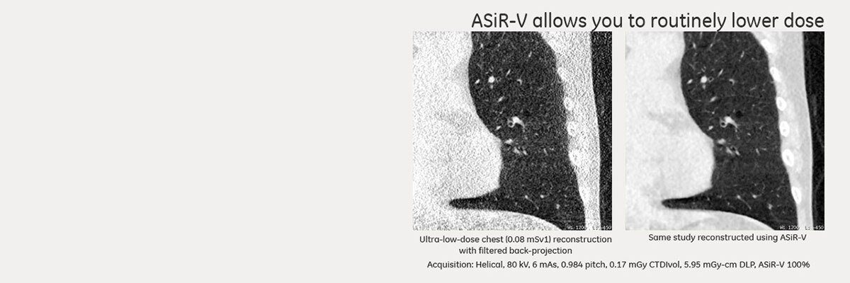 ASiR-V-banner-Revo-Evo-webpage-v1