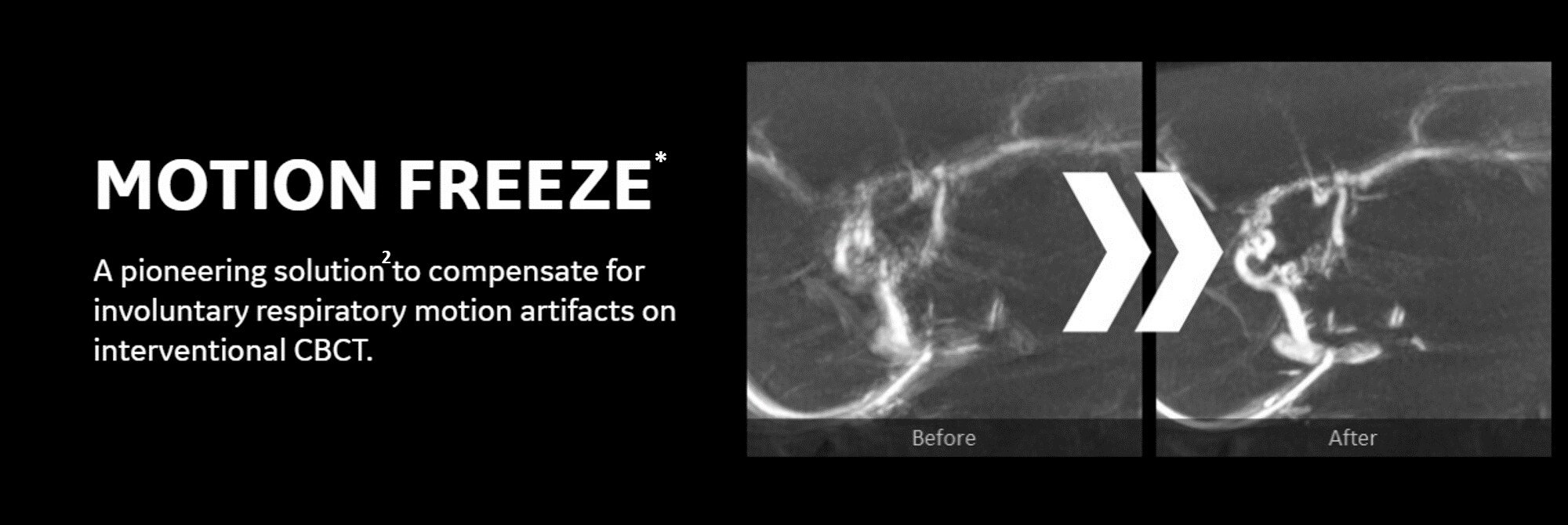 Motion Freeze