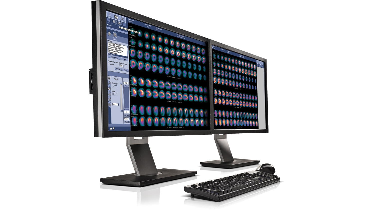 roduct-education-clinical-tip-applications-nuclear-medicine-nuclear_medicine_monitors2.jpg
