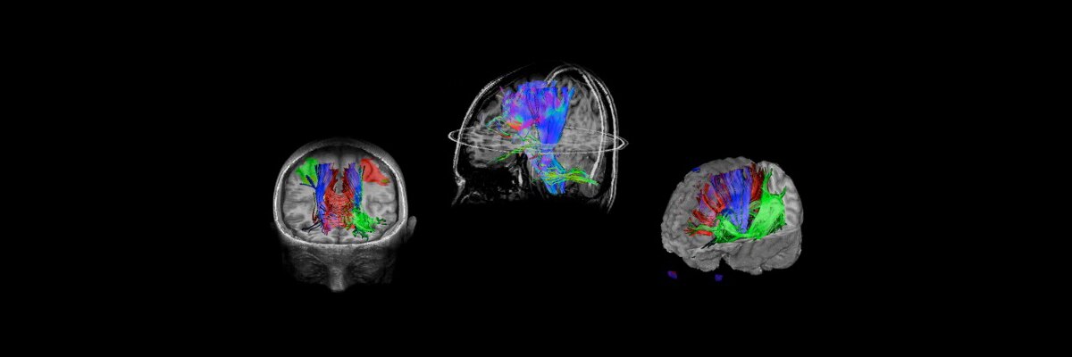 product-product-categories-magnetic-resonance-imaging-neuro-imaging-brainwave-neurobrainwave.jpg